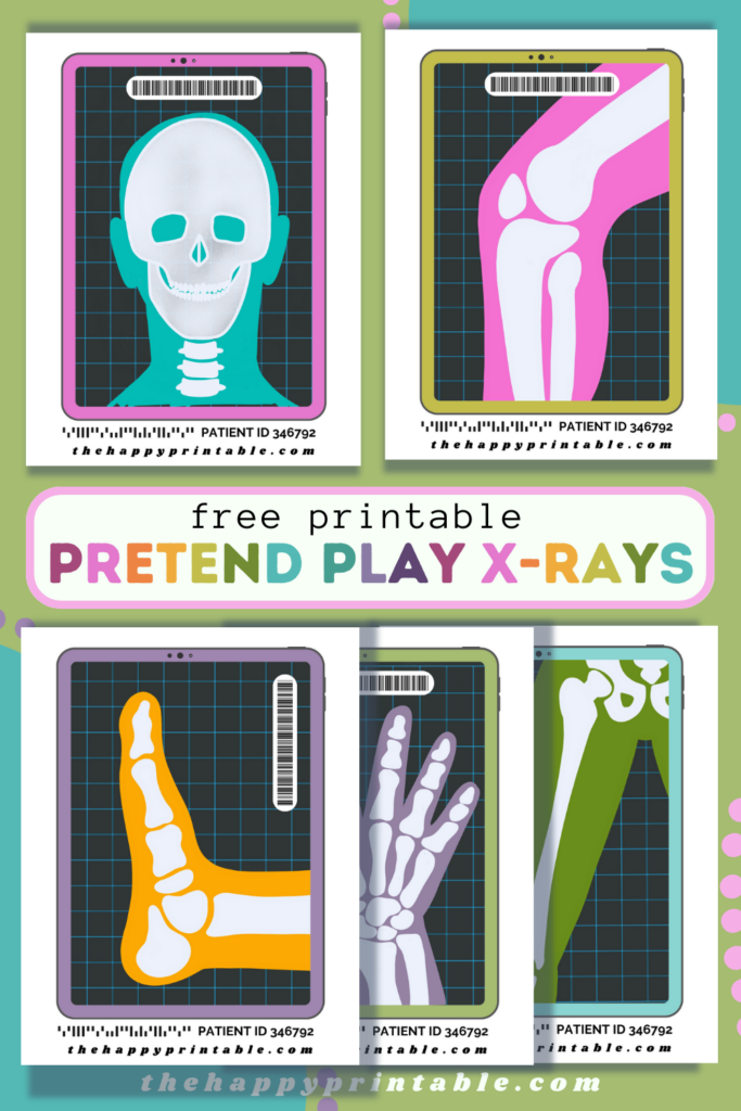 Printable Pretend X Rays The Happy Printable Dramatic Play 