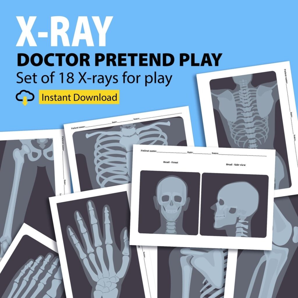 Printable X rays For Kids Pretend Play Doctors Pretend Play Nurses 