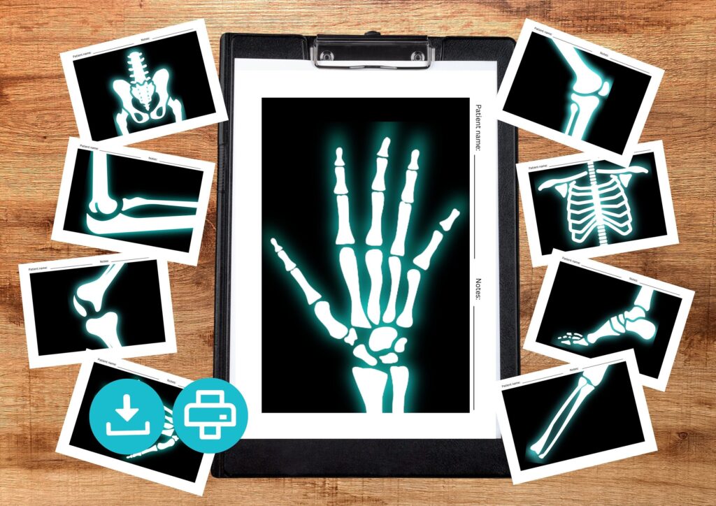 Printable X rays For Kids Pretend Play Kids X ray Activity For Playing 