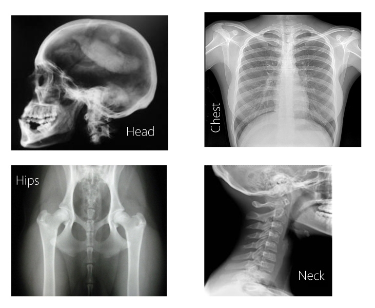 X Ray Printables For Kids